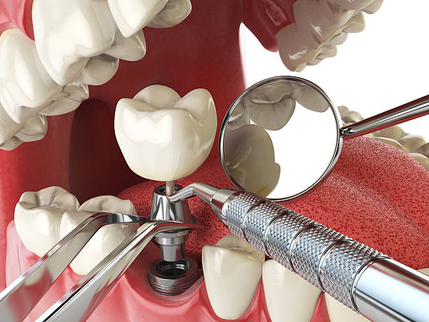 Fast & Reliable Emergency Dental Services in SC